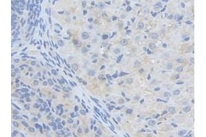 DAB staining on IHC-P; Samples: Mouse Ovary Tissue (ALDH9A1 anticorps  (AA 322-494))
