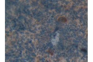 IHC-P analysis of Rat Spleen Tissue, with DAB staining. (Thrombospondin 1 anticorps  (AA 71-259))