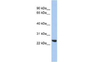 WB Suggested Anti-PSMB2 Antibody Titration: 0. (PSMB2 anticorps  (Middle Region))
