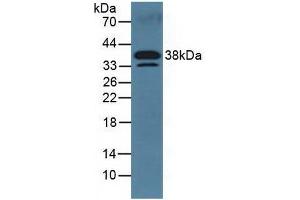 Detection of DKK3 in Mouse Serum using Polyclonal Antibody to Dickkopf Related Protein 3 (DKK3) (DKK3 anticorps  (AA 23-349))
