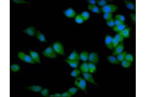 Immunofluorescence staining of Hela cells with ABIN7172139 at 1:133, counter-stained with DAPI. (PRSS16 anticorps  (AA 352-489))