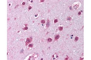 Anti-SOX12 antibody IHC of human brain, cortex.