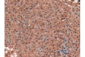 IHC-P analysis of Human Liver Tissue, with DAB staining. (TEK anticorps  (AA 1-116))