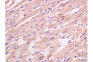 Formalin-fixed and paraffin embedded rat heart labeled with Anti-FAM134B Polyclonal Antibody, Unconjugated  at 1:200 followed by conjugation to the secondary antibody and DAB staining