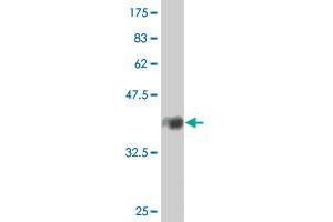 Western Blot detection against Immunogen (38.