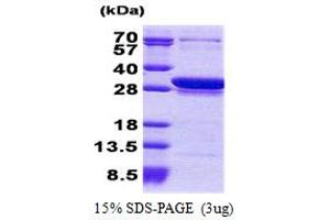 SDS-PAGE (SDS) image for Coiled-Coil Domain Containing 25 (CCDC25) (AA 1-208) protein (His tag) (ABIN5853165)