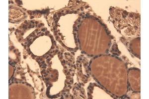 Immunohistochemistry analysis using Mouse Anti-Sodium Iodide Symporter Monoclonal Antibody, Clone 14F .