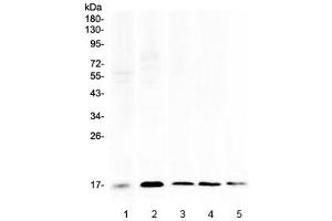 Western blot testing of 1) human placenta, 2) human HeLa, 3) rat spleen, 4) rat RH35 and 5) mouse spleen lysate with Psoriasin antibody at 0. (S100A7 anticorps)