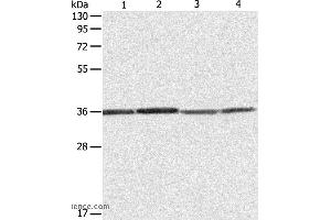 Western blot analysis of Hela, 293T, A431 and Jurkat cell, using RPLP0 Polyclonal Antibody at dilution of 1:600 (RPLP0 anticorps)