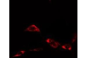 ABIN6276372 staining  NIH-3T3 cells by IF/ICC.