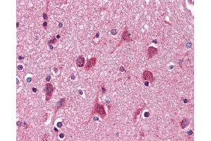 Anti-AGPS antibody IHC of human brain, cortex. (AGPS anticorps  (AA 370-628))