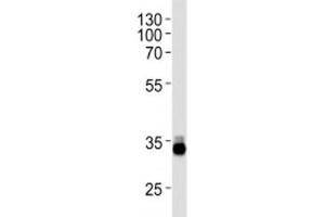 OTX2 antibody western blot analysis in Y79 lysate (OTX2 anticorps  (AA 261-289))