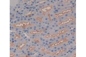 Used in DAB staining on fromalin fixed paraffin- embedded Kidney tissue