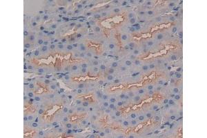 Used in DAB staining on fromalin fixed paraffin- embedded Kidney tissue (Band 3/AE1 anticorps  (AA 558-675))