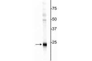 Western blot of rat hippocampal homogenate showing specific immunolabeling of the ~24 kDa UCHL1 protein. (UCHL1 anticorps)