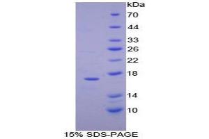 SDS-PAGE (SDS) image for Ribonuclease, RNase A Family, 1 (Pancreatic) (RNASE1) (AA 29-156) protein (His tag) (ABIN1080670) (RNASE1 Protein (AA 29-156) (His tag))