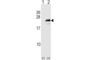 Western Blotting (WB) image for anti-Neurogenin 3 (NEUROG3) antibody (ABIN3001396) (Neurogenin 3 anticorps)