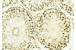 ABIN6269184 at 1/100 staining Mouse testis tissue by IHC-P. (ELK1 anticorps  (C-Term))