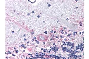 Image no. 1 for anti-Prostaglandin E Receptor 3 (Subtype EP3) (PTGER3) (Cytoplasmic Domain) antibody (ABIN302631)