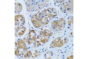 Immunohistochemistry of paraffin-embedded human stomach using IMPA1 antibody. (IMPA1 anticorps  (AA 1-277))