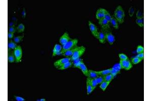 Immunofluorescent analysis of Hela cells using ABIN7156292 at dilution of 1:100 and Alexa Fluor 488-congugated AffiniPure Goat Anti-Rabbit IgG(H+L) (IMPDH2 anticorps  (AA 5-514))