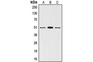 Western blot analysis of VDR expression in HeLa (A), T47D (B), MCF7 (C) whole cell lysates. (Vitamin D Receptor anticorps  (Center))