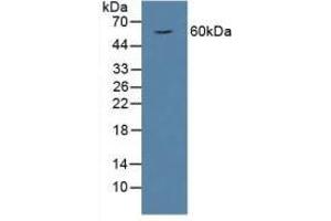 Detection of HPSE in Rat Serum using Polyclonal Antibody to Heparanase (HPSE) (HPSE anticorps  (AA 40-188))