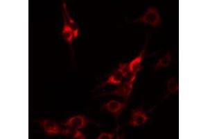 ABIN6274994 staining HuvEc by IF/ICC. (CBLN1 anticorps  (C-Term))
