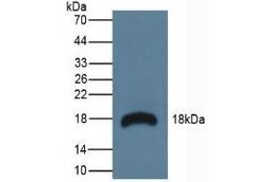 Detection of RNASE3 in Mouse Lymphonodus Tissue using Polyclonal Antibody to Ribonuclease A3 (RNASE3)
