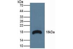 Detection of RNASE3 in Mouse Lymphonodus Tissue using Polyclonal Antibody to Ribonuclease A3 (RNASE3) (RNASE3 anticorps  (AA 34-150))