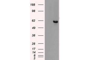 Image no. 7 for anti-Checkpoint Kinase 2 (CHEK2) antibody (ABIN1497497)