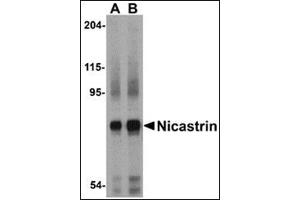 Western blot analysis of Nicastrin in human brain tissue lysate with this product at (A) 0. (Nicastrin anticorps  (Center))