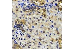 Immunohistochemical analysis of B9D1 staining in rat kidney formalin fixed paraffin embedded tissue section. (B9D1 anticorps)