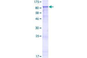 Image no. 1 for Zinc Finger Protein 549 (ZNF549) (AA 1-640) protein (GST tag) (ABIN1326277)