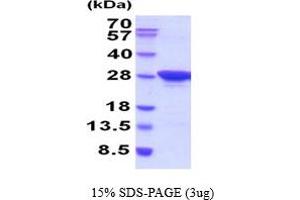SDS-PAGE (SDS) image for Mesoderm Development Candidate 2 (MESDC2) (AA 30-224) protein (His tag) (ABIN6387715)