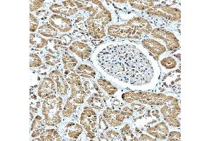 IHC analysis of CBS using anti-CBS antibody (ABIN7599637).