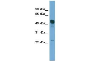 WB Suggested Anti-DYX1C1 Antibody Titration: 0. (DYX1C1 anticorps  (Middle Region))