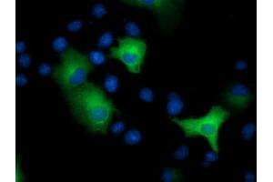 Immunofluorescence (IF) image for anti-Epoxide Hydrolase 2, Cytoplasmic (EPHX2) antibody (ABIN1500856) (EPHX2 anticorps)