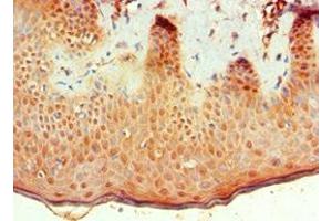 Immunohistochemistry of paraffin-embedded human skin tissue using ABIN7145683 at dilution of 1:100 (BMP15 anticorps  (AA 143-392))