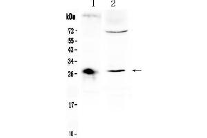 Western blot analysis of CD151 using anti- CD151 antibody . (CD151 anticorps  (AA 113-175))