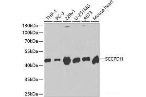 Western blot analysis of extracts of various cell lines using SCCPDH Polyclonal Antibody at dilution of 1:1000.