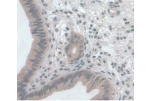 DAB staining on IHC-P Samples:Mouse Uterus Tissue)