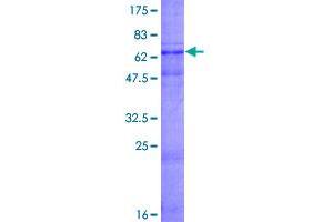 Image no. 1 for Wnt1 Inducible Signaling Pathway Protein 3 (WISP3) (AA 1-372) protein (GST tag) (ABIN1325345)