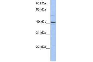 PELI3 antibody used at 1 ug/ml to detect target protein. (Pellino 3 anticorps)