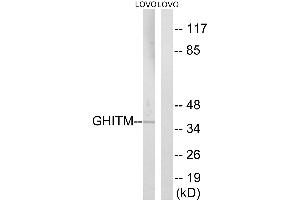 Western blot analysis of extracts from LOVO cells, using GHITM antibody. (GHITM anticorps  (Internal Region))