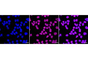Immunocytochemical staining of HeLa cells with C-terminal binding protein 2 antibody (ABIN7797816), 1:1,000). (Recombinant CTBP2 anticorps)