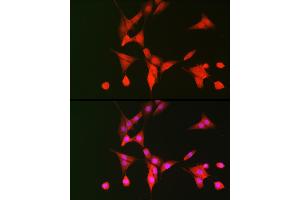 Immunofluorescence analysis of NIH/3T3 cells using p70 S6 Kinase 1 Rabbit pAb (ABIN7270029) at dilution of 1:100 (40x lens).