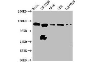 Western Blot Positive WB detected in: Hela whole cell lysate, SH-SY5Y whole cell lysate, A549 whole cell lysate, PC-3 whole cell lysate, COLO320 whole cell lysate All lanes: MAML2 antibody at 2.