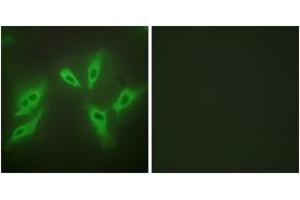 Immunofluorescence analysis of HeLa cells, using TUSC3 Antibody. (TUSC3 anticorps  (AA 131-180))