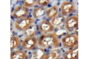 Used in DAB staining on fromalin fixed paraffin-embedded Kidney tissue (PAFAH1B3 anticorps  (AA 1-232))